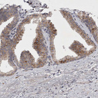 Immunohistochemical staining of human prostate shows moderate granular cytoplasmic positivity in glandular cells.