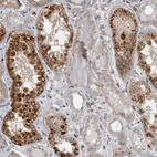 Immunohistochemical staining of human kidney shows strong granular cytoplasmic positivity in subset of cells in tubules.