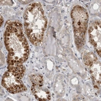 Immunohistochemical staining of human kidney shows strong granular cytoplasmic positivity in subset of cells in tubules.