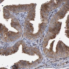 Immunohistochemical staining of human fallopian tube shows moderate cytoplasmic positivity in glandular cells.