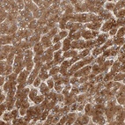 Anti-ZNF160 Antibody