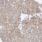 Anti-AFP Antibody