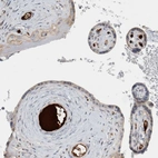 Immunohistochemical staining of human Placenta shows moderate positivity in extracellular matrix in trophoblastic cells.