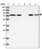 Lane 1: Marker [kDa] 230, 130, 95, 72, 56, 36, 28, 17, 11_br/_Lane 2: Human cell line RT-4_br/_Lane 3: Human cell line U-251MG sp_br/_Lane 4: Human plasma (IgG/HSA depleted)_br/_Lane 5: Human liver tissue_br/_Lane 6: Human tonsil tissue