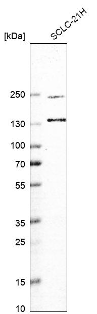Anti-UBE2O Antibody