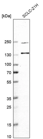 Anti-UBE2O Antibody
