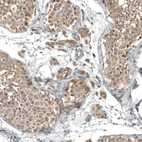 Immunohistochemical staining of human testis shows moderate cytoplasmic positivity in Leydig cells.