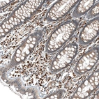 Immunohistochemical staining of human rectum shows strong cytoplasmic positivity in lymphoid cells.