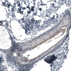 Immunohistochemical staining of human skin shows very weak cytoplasmic positivity in squamous epithelial cells.