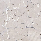 Anti-SURF6 Antibody