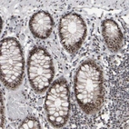 Immunohistochemical staining of human colon shows strong positivity in nucleoli in glandular cells and lymphoid cells.