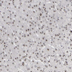 Immunohistochemical staining of human liver shows strong positivity in nucleoli in hepatocytes.