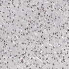 Immunohistochemical staining of human liver shows strong positivity in nucleoli in hepatocytes.