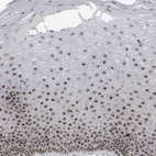 Immunohistochemical staining of human cervix, uterine shows strong positivity in nucleoli in squamous epithelial cells.