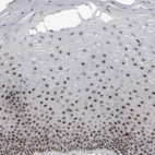 Immunohistochemical staining of human cervix, uterine shows strong positivity in nucleoli in squamous epithelial cells.