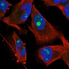 Immunofluorescent staining of human cell line U-251 MG shows localization to nucleus & nucleoli.