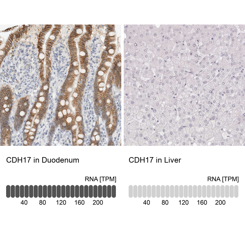 Anti-CDH17 Antibody