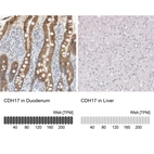 Anti-CDH17 Antibody