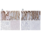 Immunohistochemical staining of human colon, duodenum, kidney and liver using Anti-CDH17 antibody HPA023614 (A) shows similar protein distribution across tissues to independent antibody HPA023616 (B).
