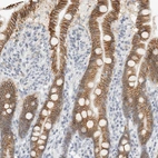 Immunohistochemical staining of human duodenum shows strong membranous positivity in glandular cells.