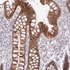 Immunohistochemical staining of human colon shows strong membranous positivity in glandular cells.