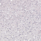 Immunohistochemical staining of human liver shows no positivity in hepatocytes as expected.