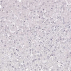 Immunohistochemical staining of human liver shows no positivity in hepatocytes as expected.
