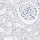 Immunohistochemical staining of human kidney shows no positivity in cells in tubules as expected.