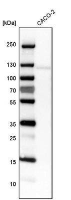 Western blot analysis in human cell line CACO-2.