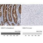 Anti-CDH17 Antibody