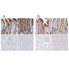 Immunohistochemical staining of human colon, duodenum, kidney and liver using Anti-CDH17 antibody HPA023616 (A) shows similar protein distribution across tissues to independent antibody HPA023614 (B).