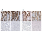 Immunohistochemical staining of human colon, duodenum, kidney and liver using Anti-CDH17 antibody HPA023616 (A) shows similar protein distribution across tissues to independent antibody HPA023614 (B).