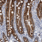 Immunohistochemical staining of human duodenum shows strong membranous positivity in glandular cells.