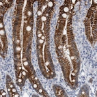 Immunohistochemical staining of human duodenum shows strong membranous positivity in glandular cells.