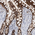 Immunohistochemical staining of human colon shows strong membranous positivity in glandular cells.