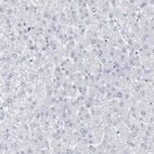 Anti-CDH17 Antibody