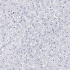 Immunohistochemical staining of human liver shows no positivity in hepatocytes as expected.