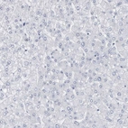 Immunohistochemical staining of human liver shows no positivity in hepatocytes as expected.