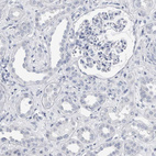Immunohistochemical staining of human kidney shows no positivity in cells in tubules as expected.
