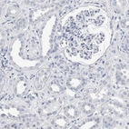 Immunohistochemical staining of human kidney shows no positivity in cells in tubules as expected.
