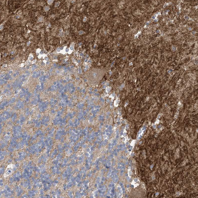 Anti-TTYH1 Antibody
