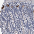 Immunohistochemical staining of human duodenum shows moderate positivity in Paneth cells.