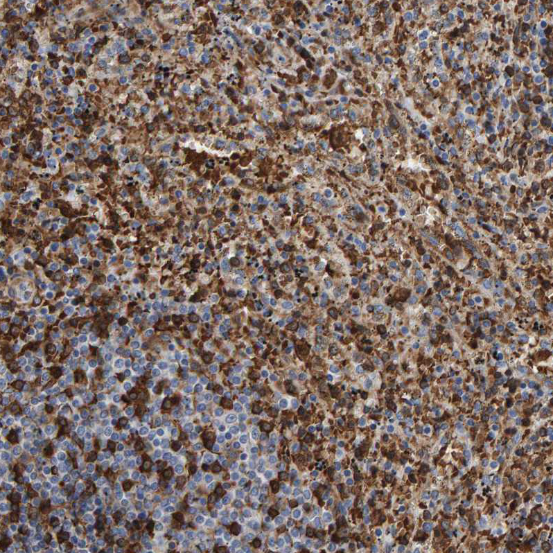 Anti-VPS9D1 Antibody