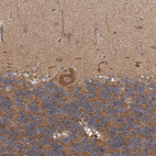Immunohistochemical staining of human cerebellum shows moderate cytoplasmic positivity in Purkinje cells.