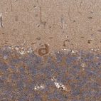 Immunohistochemical staining of human cerebellum shows moderate cytoplasmic positivity in Purkinje cells.
