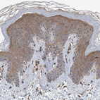 Immunohistochemical staining of human skin shows moderate cytoplasmic positivity in squamous epithelial cells.
