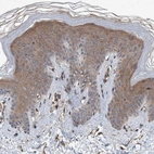 Immunohistochemical staining of human skin shows moderate cytoplasmic positivity in squamous epithelial cells.