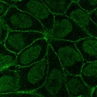 Immunofluorescent staining of human cell line RT4 shows localization to nucleoplasm & cell junctions.