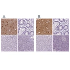 Immunohistochemical staining of human cerebral cortex, colon, liver and pancreas using Anti-NECAB1 antibody HPA023629 (A) shows similar protein distribution across tissues to independent antibody HPA025963 (B).