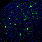 Immunofluorescence staining of mouse vestibular nucleus shows immunoreactivity in a subset of neurons.